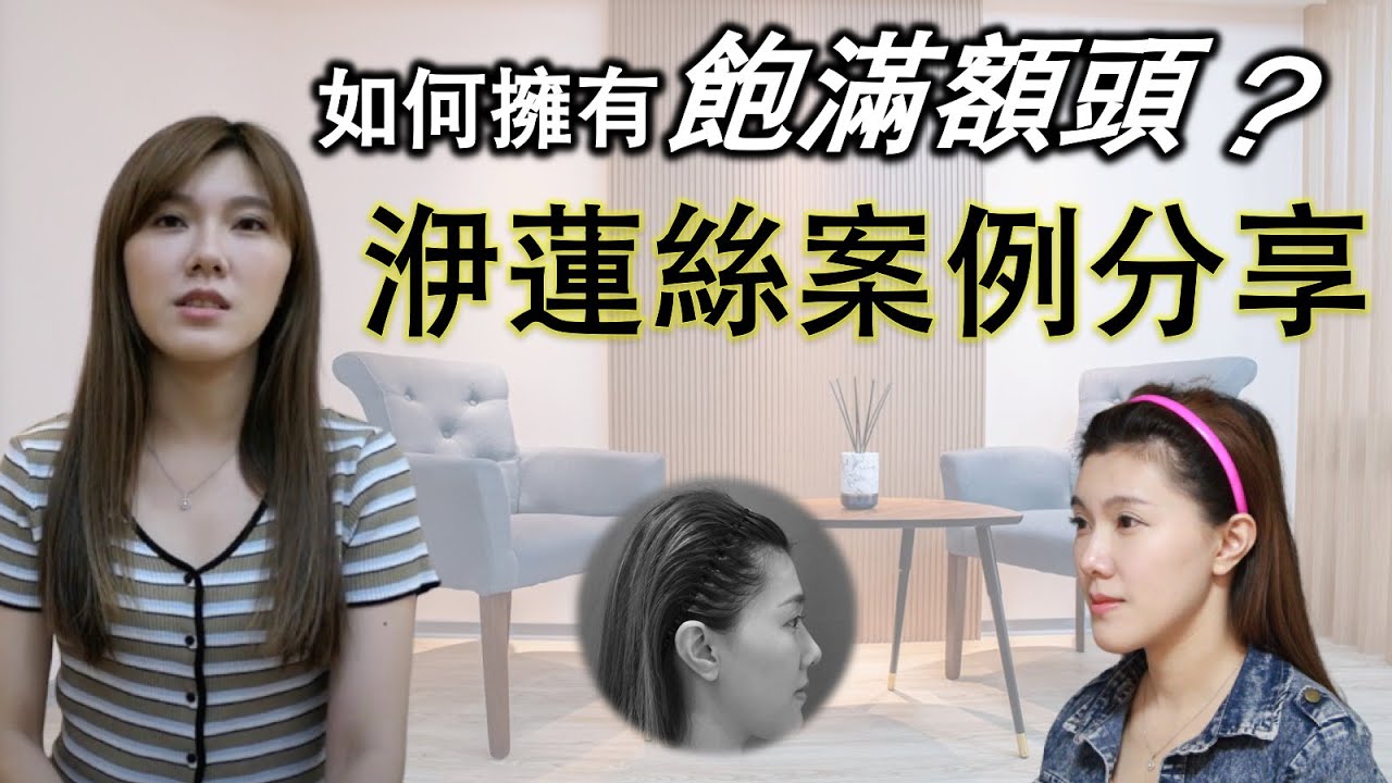 蔡秉諺醫師洢蓮絲豐額案例::高雄沐妍時尚美學診所｜微整形｜