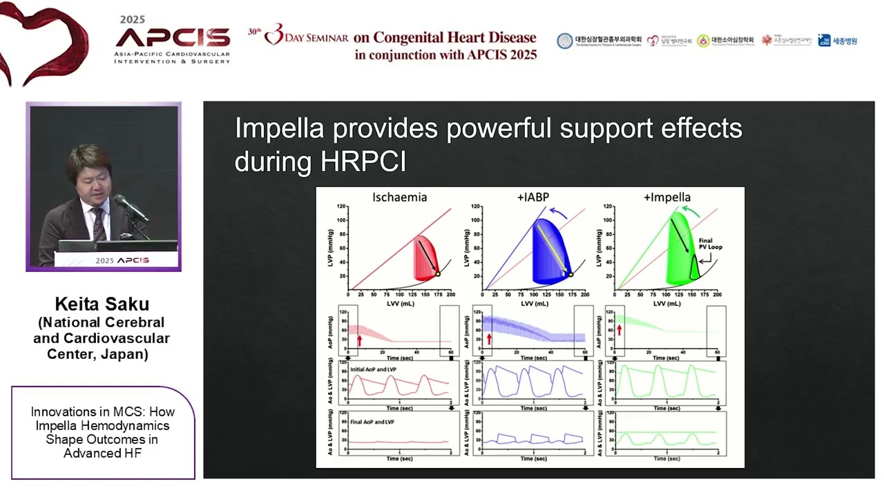 Innovations in MCS: How Impella Hemodynamics Shape Outcomes in Advanced HF