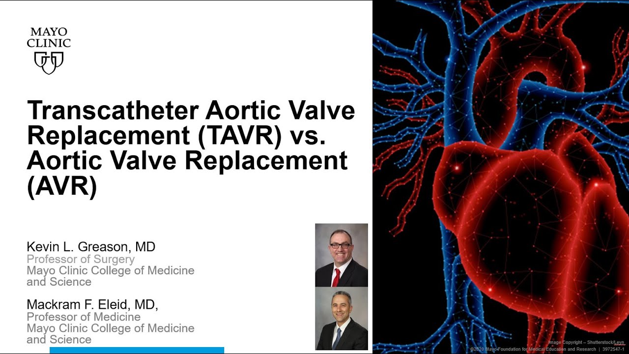Transcatheter Aortic Valve Replacement (TAVR) vs. Aortic Valve Replacement (AVR) (TAVR vs. AVR)