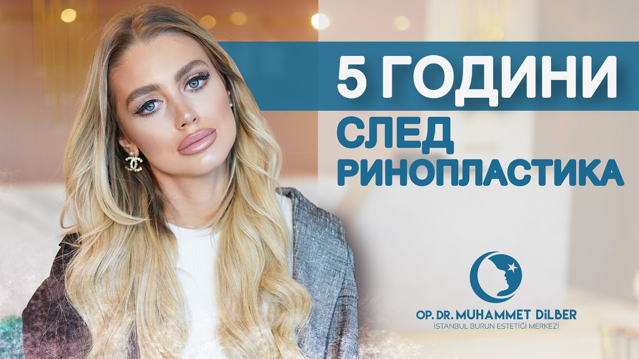 5 години след ринопластика