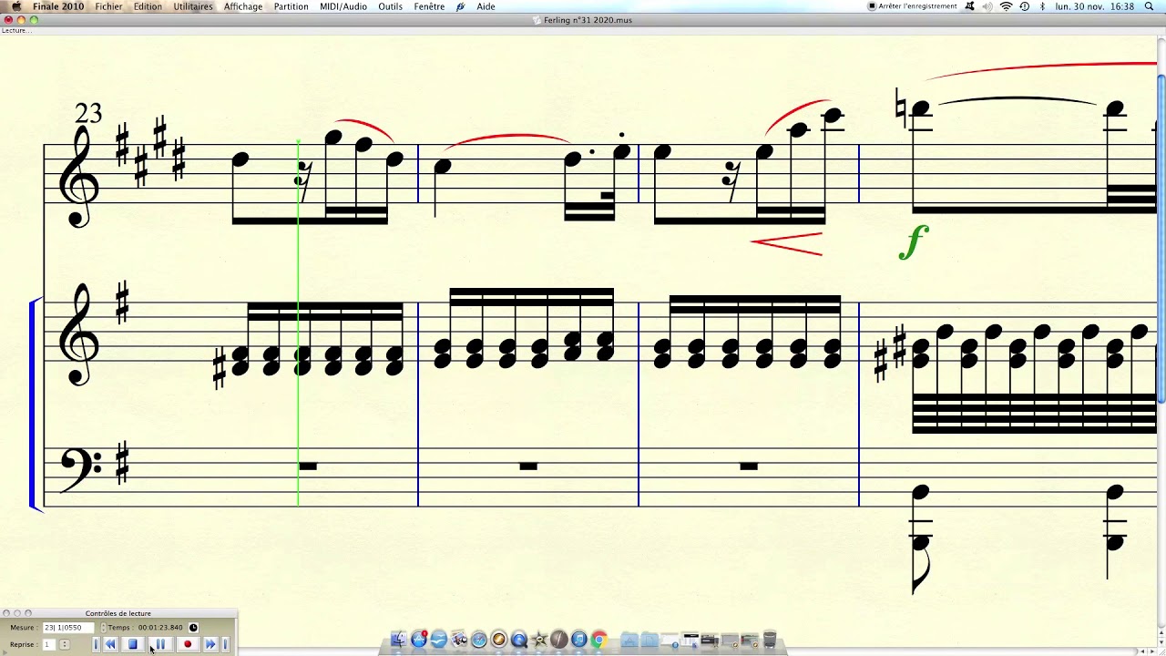 Projet FERLING Etude n°31