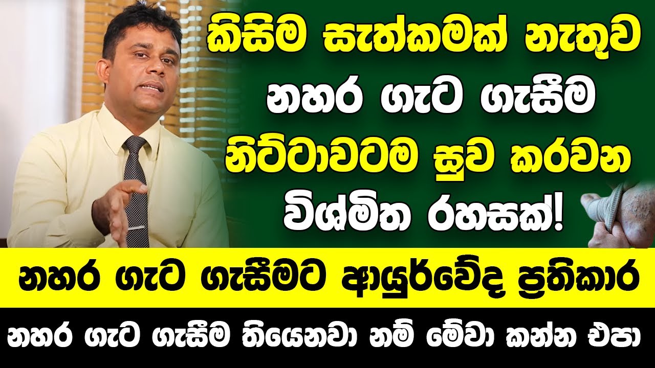 කිසිම සැත්කමක් නැතුව නහර ගැට ගැසීම නිට්ටාවටම සුව කරවන රහසක්! | නහර ගැට ගැසීමට ආයුර්වේද ප්‍රතිකාර