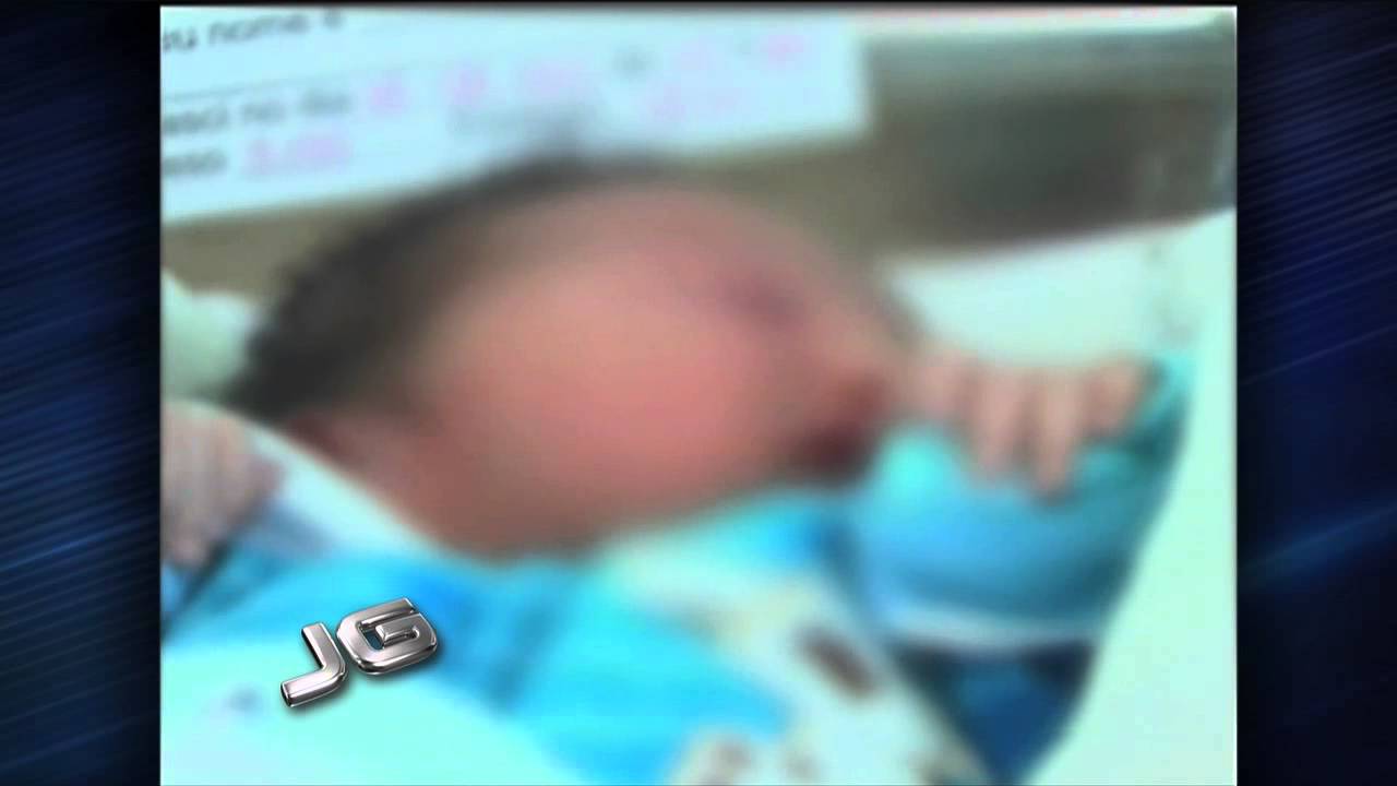 Campinas investiga tuberculose em bebês