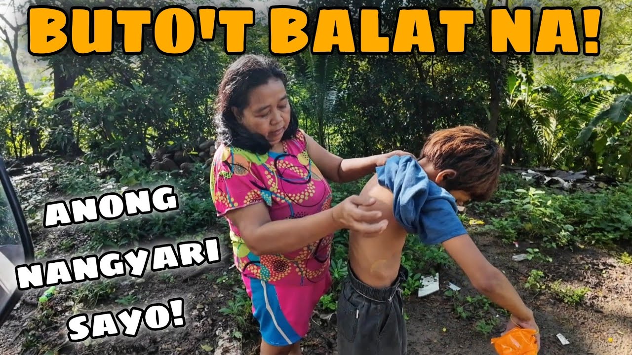 DELIKADO ANG ISA SA MGA KAMBAL! 😔