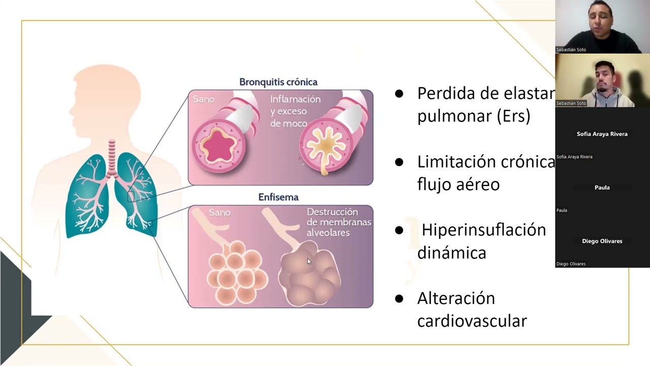 Fisiopatologia EPOC y uso de VMNI