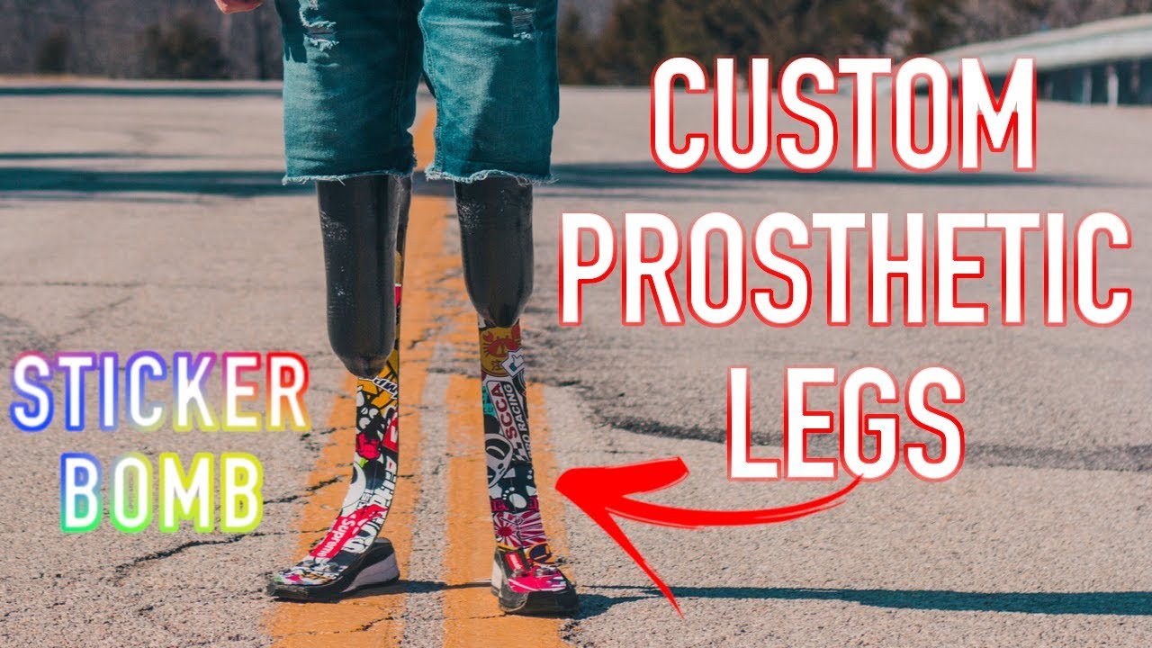 Custom Prosthetic Leg - STICKER BOMB! (DESTROYED)