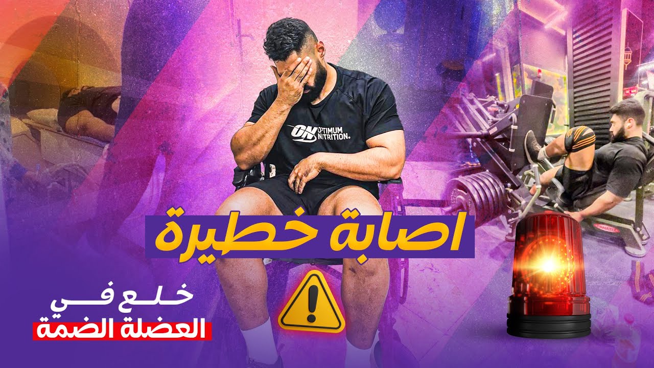 اتصبت اصابة خطيرة فى التمرين 🚨| خلع فى العضلة!!!