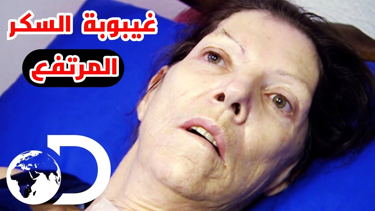 تتصرف ازاي لو شخص دخل في غيبوبة سكر مرتفع _ Hyperglycemia: Definition, Identification and Treatment