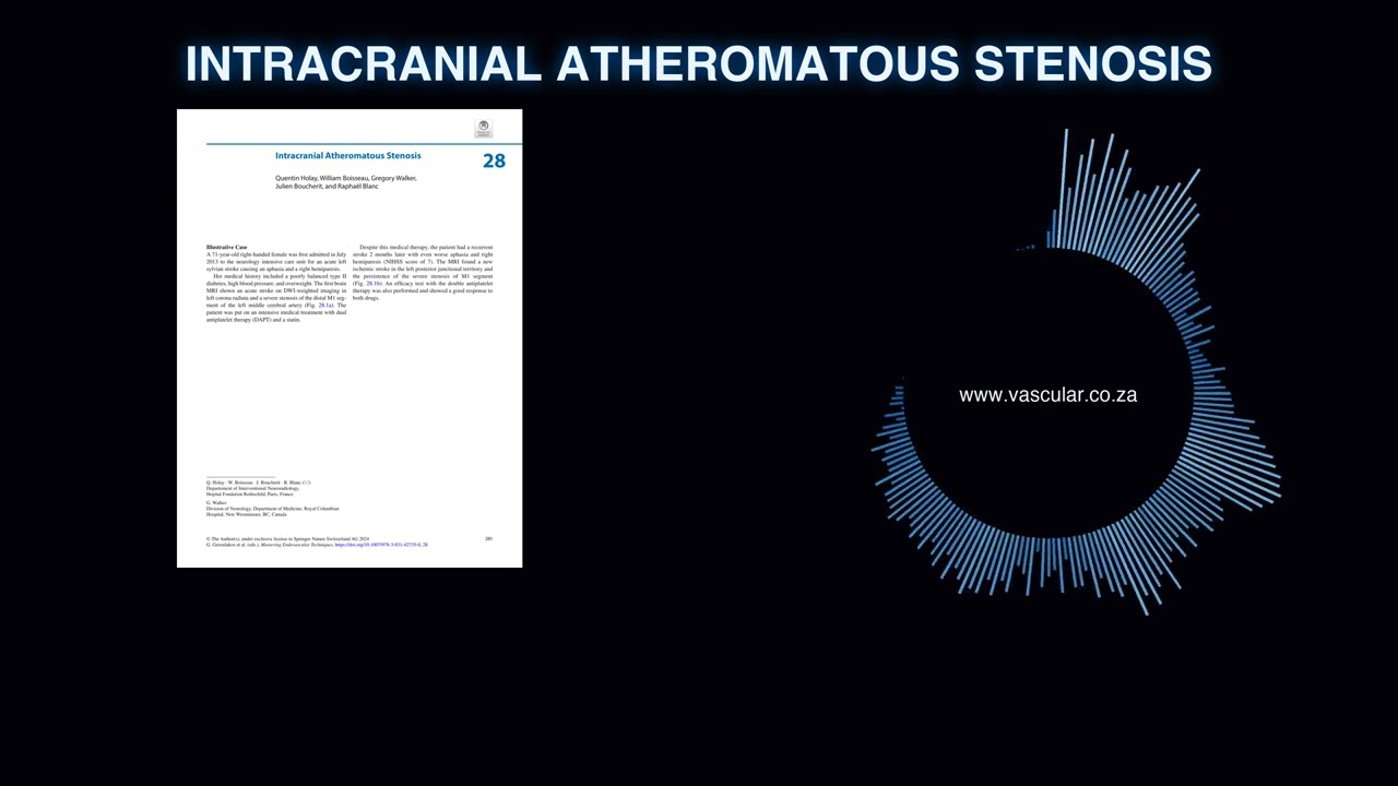 MET - 28 - Intracranial Atheromatous Stenosis - Deep Dive Podcast