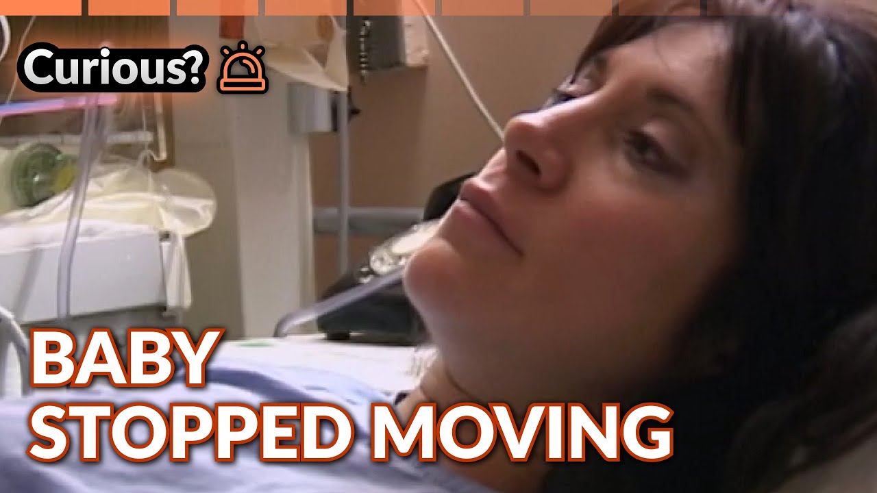 Baby Stopped Moving Emergency Induction Goes Wrong