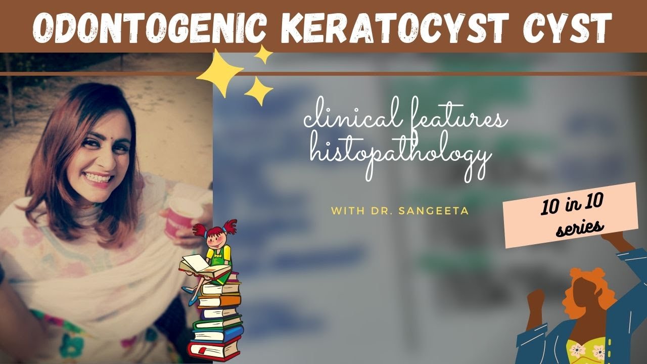 odontogenic keratocyst lecture