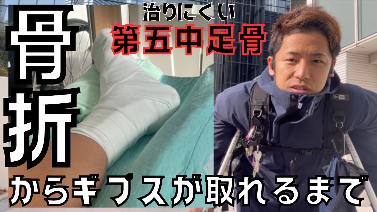 【骨折①】足の骨が折れました【治し方/リハビリ】
