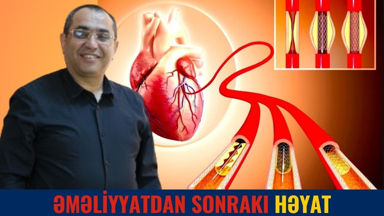 Ürək Əməliyyatından sonra Bunlara Diqqət Etmək lazımdır?