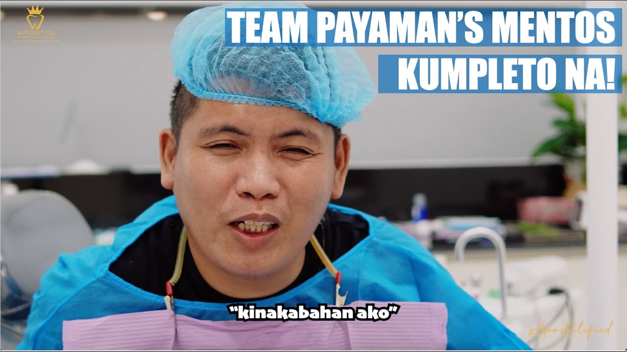 Team Payaman's Mentos Smile Makeover | Apostol Dental Philippines