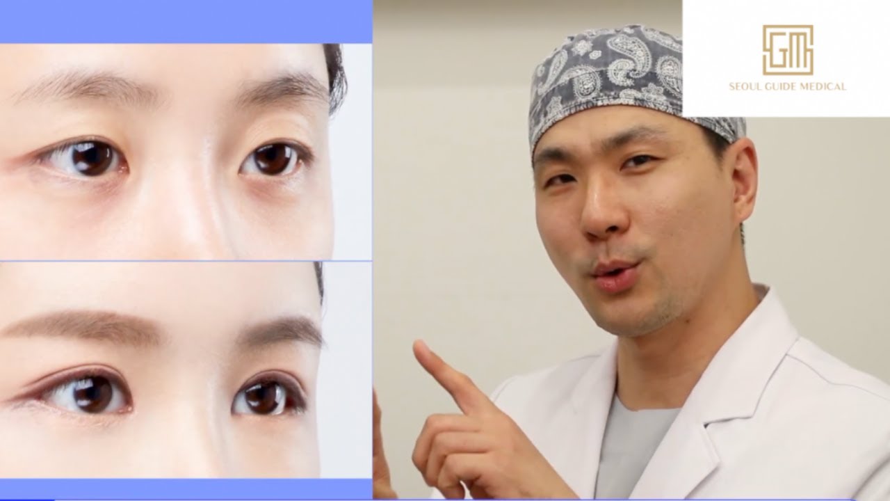 Korean Plastic Surgeon Walks Us Through A Procedure | Seoul Guide Medical