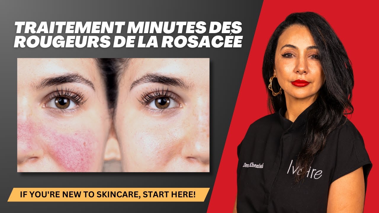 Traitement minutes des rougeurs de la rosac&eacute;e