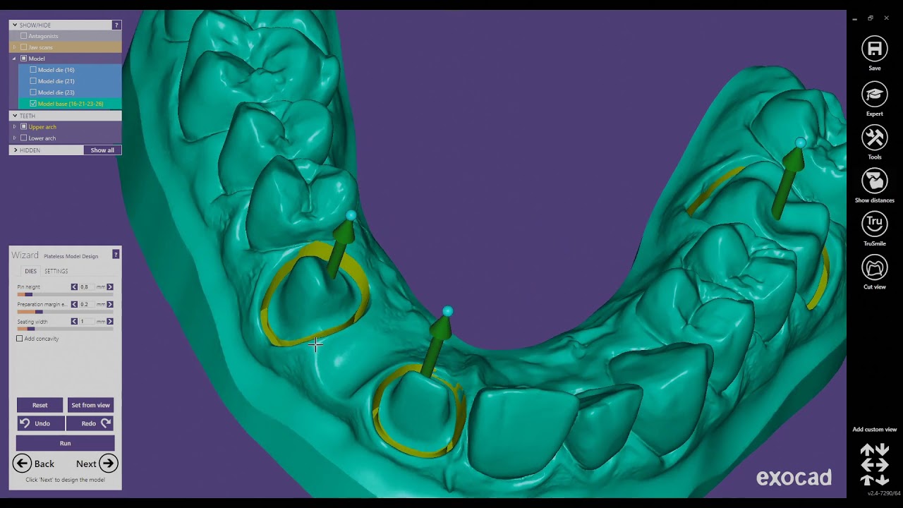 Form 3B - Solid Models with Working Dies in ExoCAD Model Creator