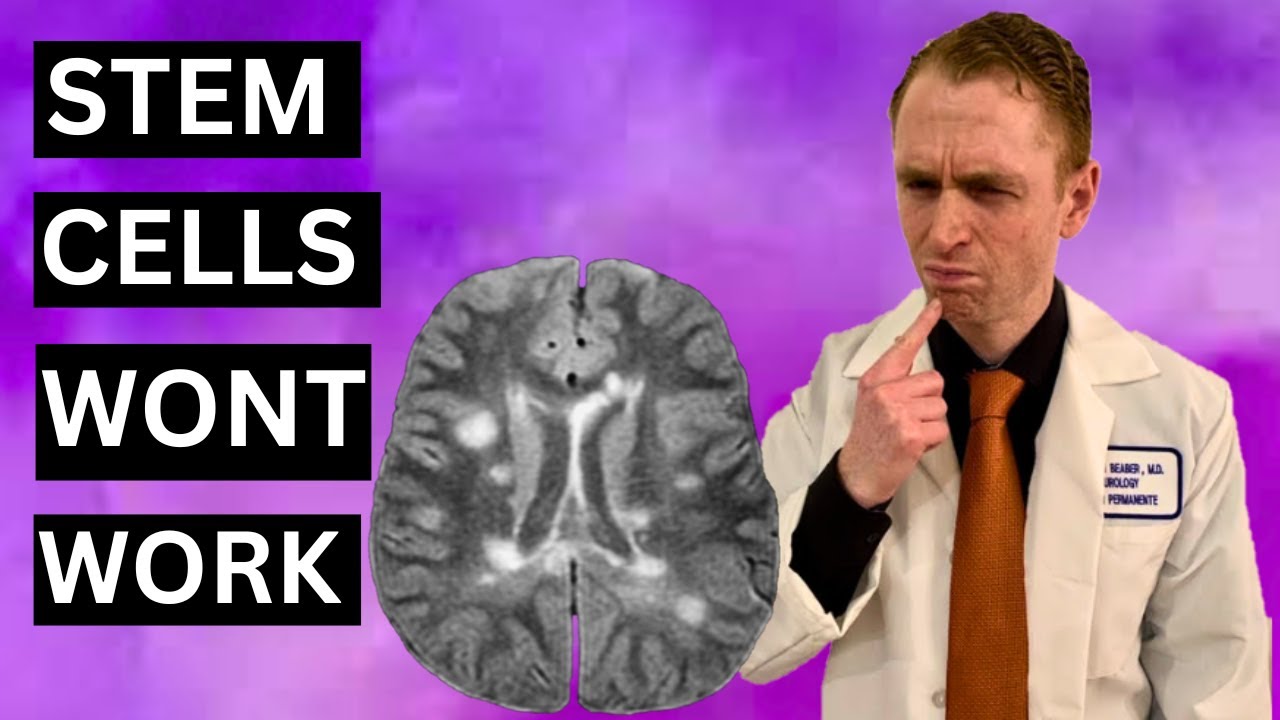 MS: Stem Cells Won't Work