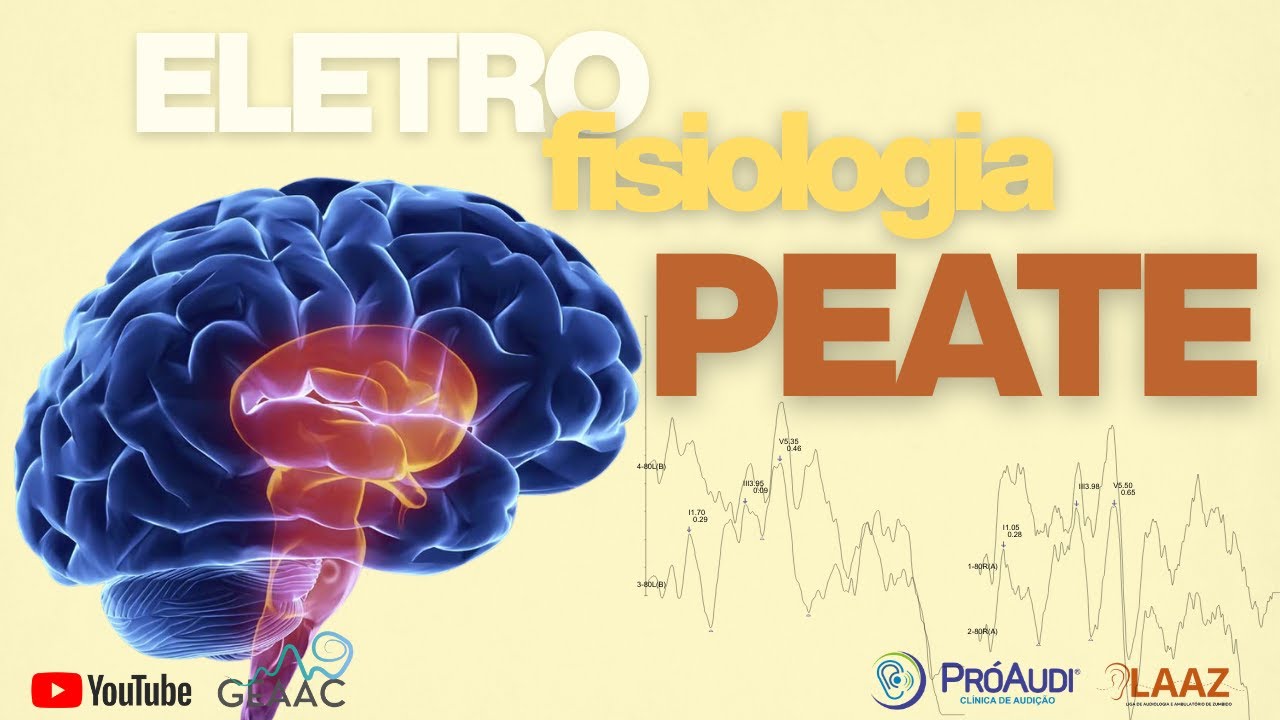 Eletrofisiologia na Prática: PEATE e Avaliação do Zumbido