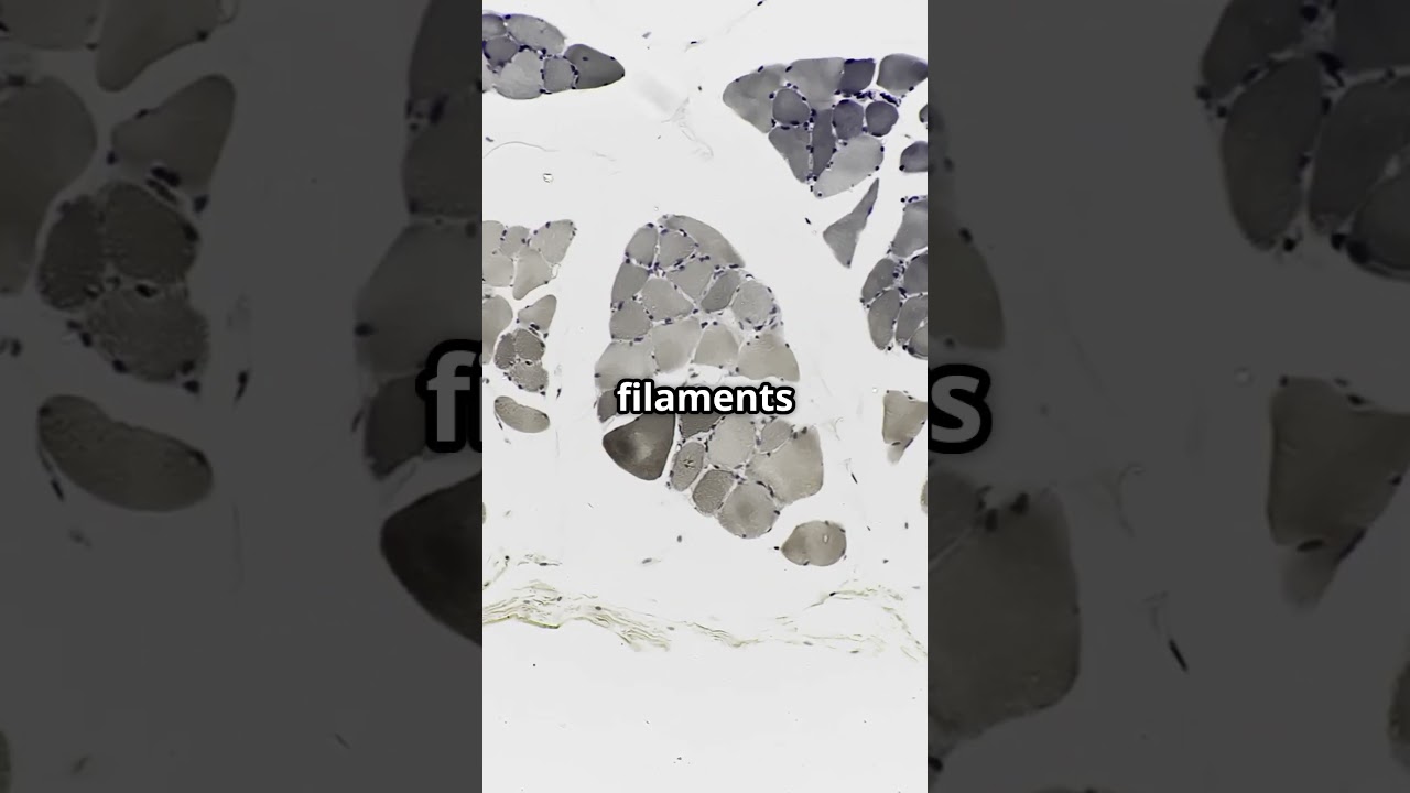 How Do Your Muscles Move?  Muscle Contraction Explained #animatedscience #science #biology