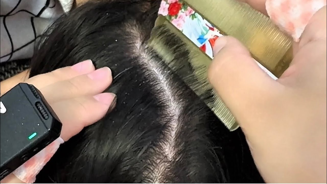 ASMR Dandruff Removal: Satisfying Comb & Tweezers Session