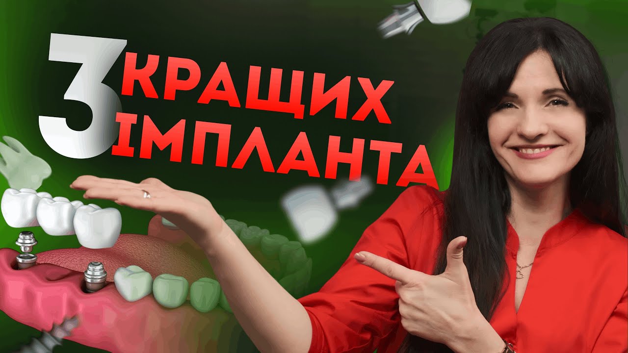 Які зубні імпланти КРАЩІ у 2026? 3 НАЙКРАЩИХ імпланта!