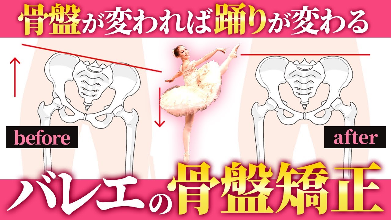 【大人バレエ】骨盤が変われば踊りが変わる！バレエの骨盤矯正