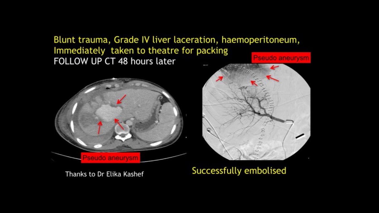 Elisabeth Dick   Polytrauma key imagins feature for key decision