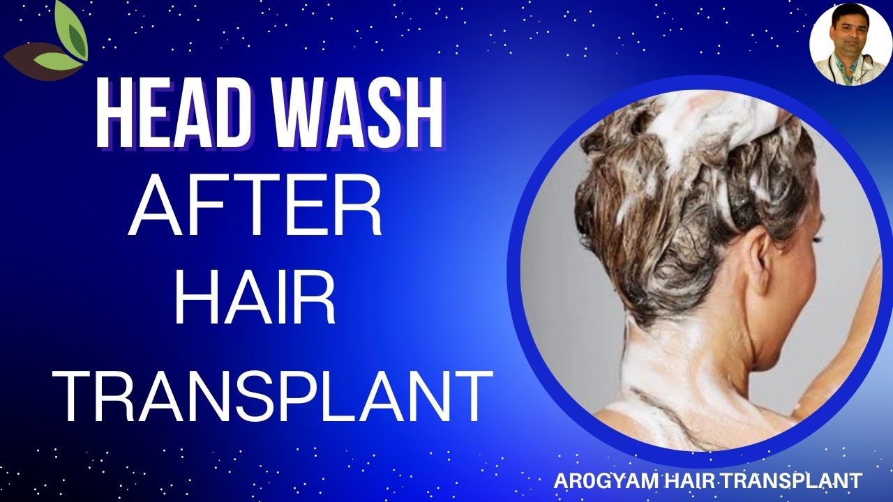 Hair Transplant Guwahati Assam || Head washing after hair transplant