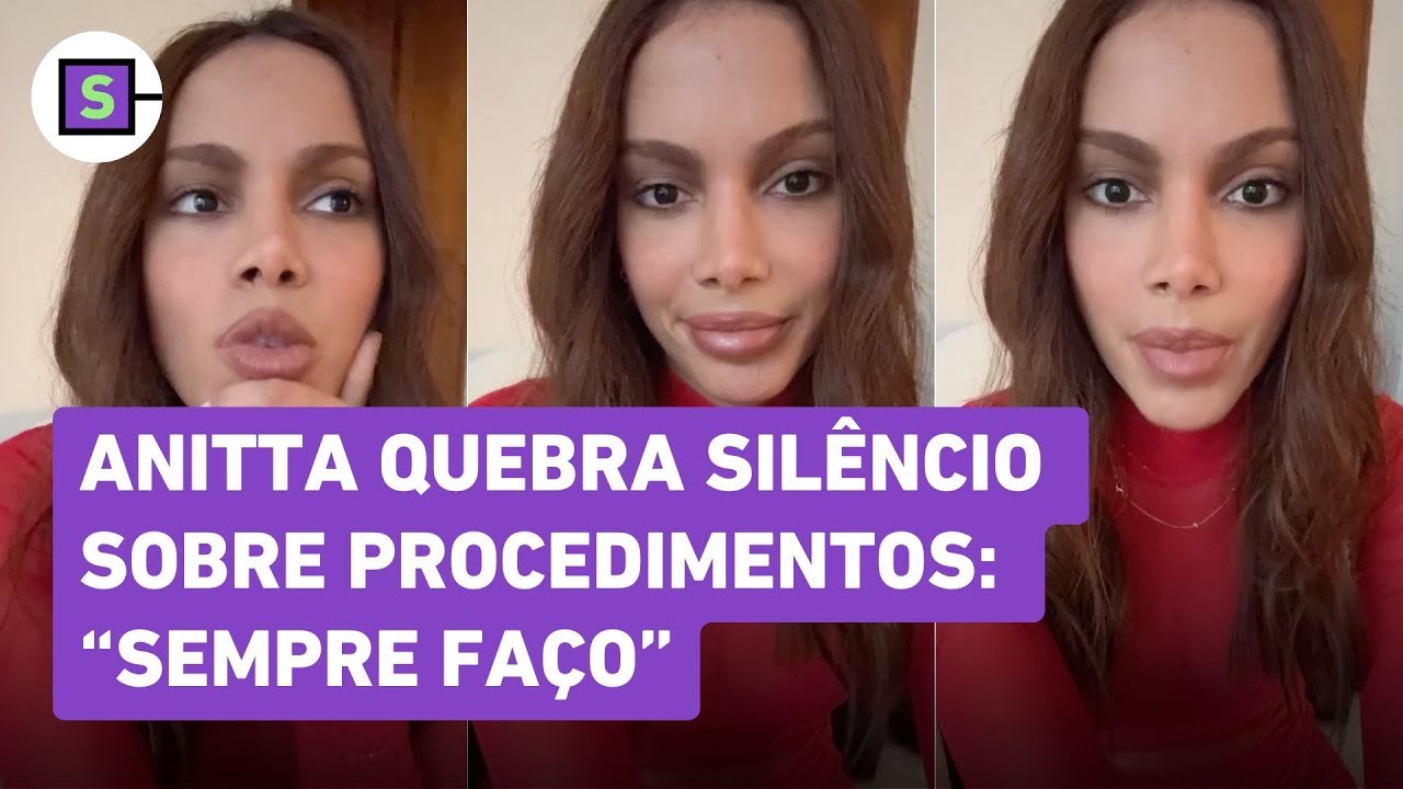 Anitta fala pela primeira vez sobre novo procedimento no rosto: 'Problema é meu'