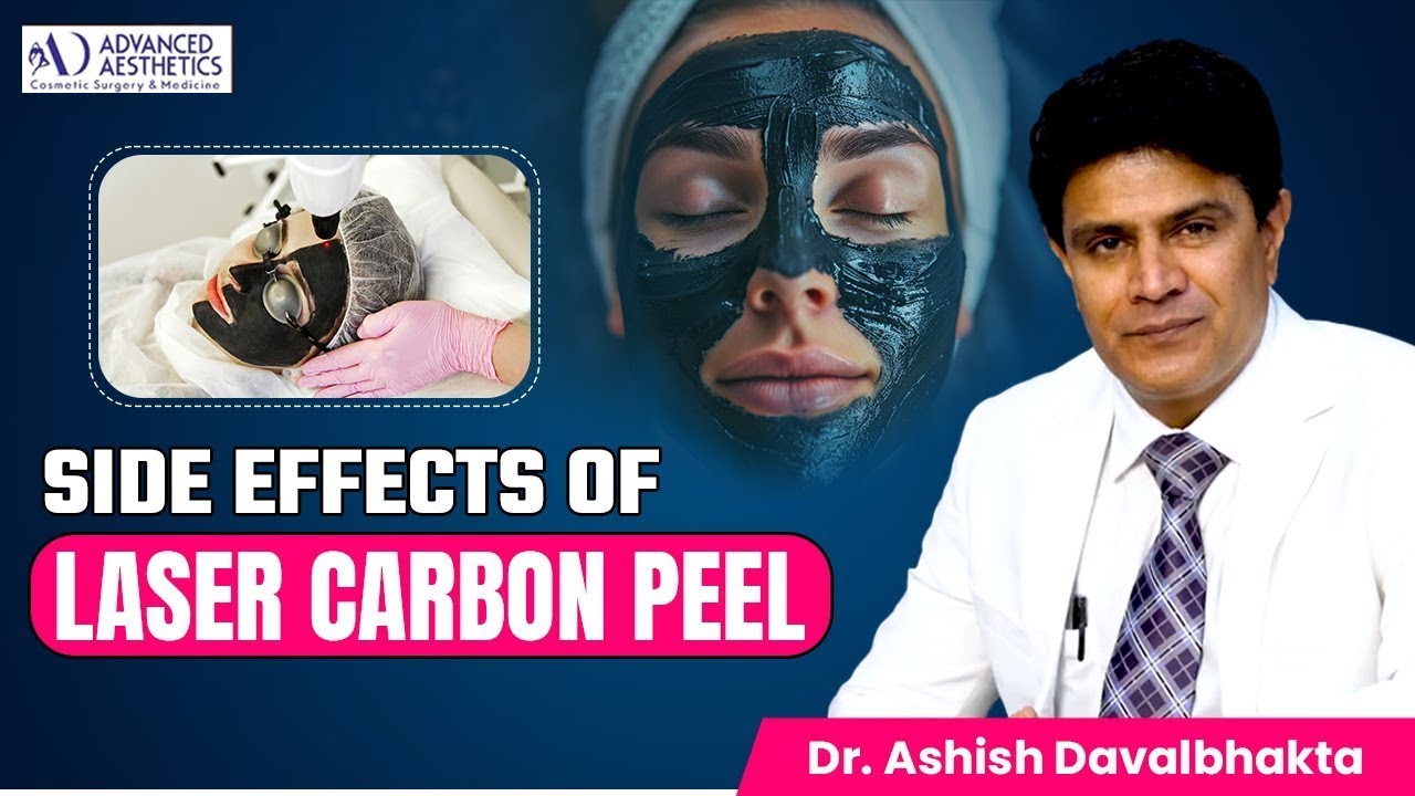 Can Laser Carbon Peel Damage Your Skin? Risks & Reality | Dr Ashish Davalbhakta Pune
