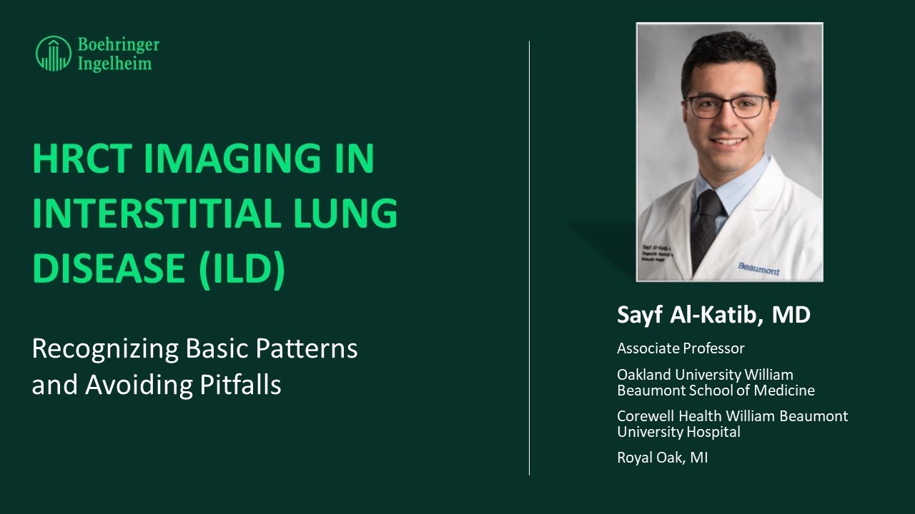 Seeing is Believing: The Role of High Resolution CT HRCT Imaging in Interstitial Lung Disease ILD