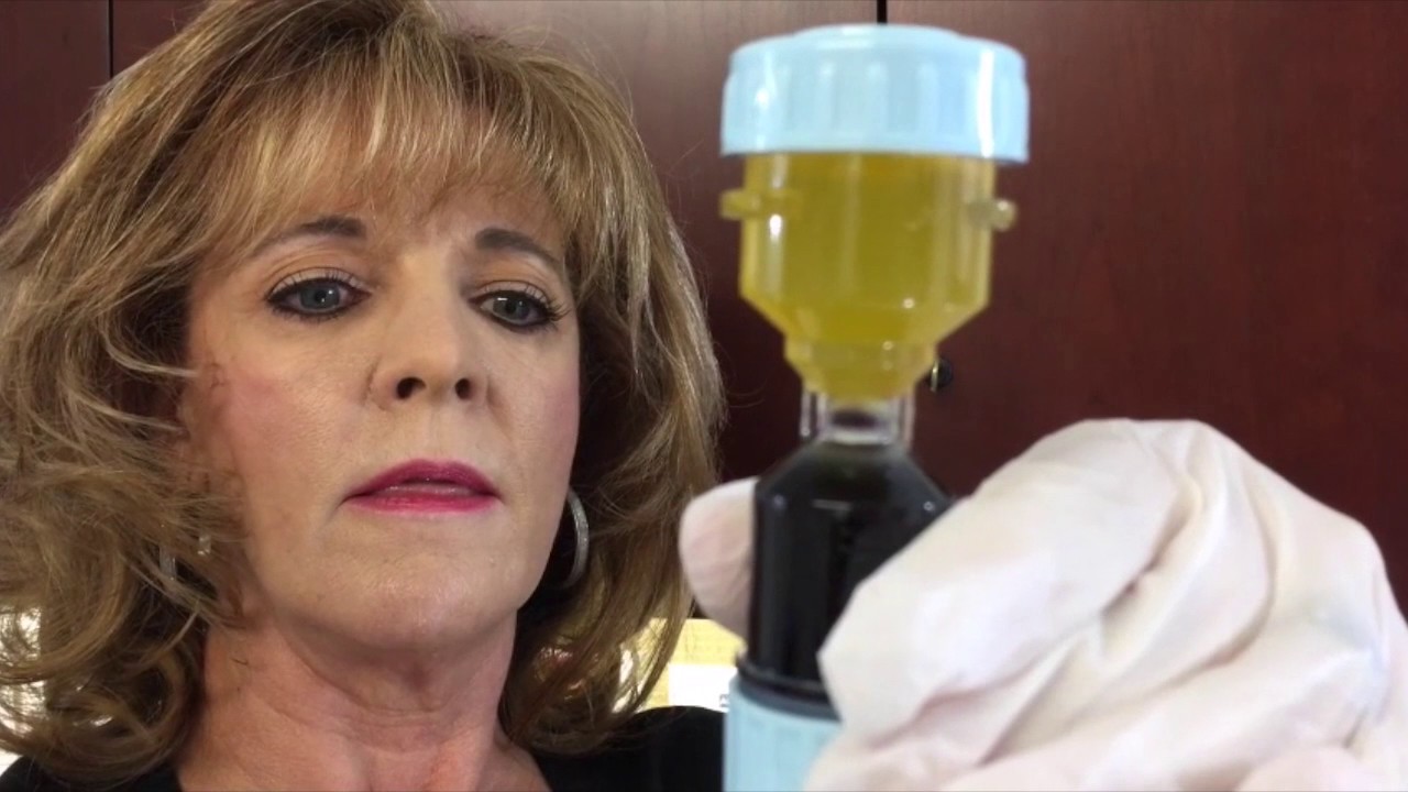 How to prepare Platelet Rich Plasma