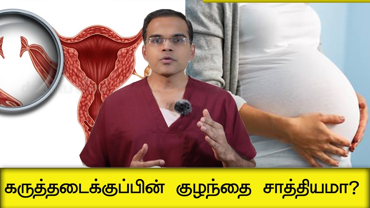கருத்தடைக்குப்பின் குழந்தை சாத்தியமா? Tube Recanalization