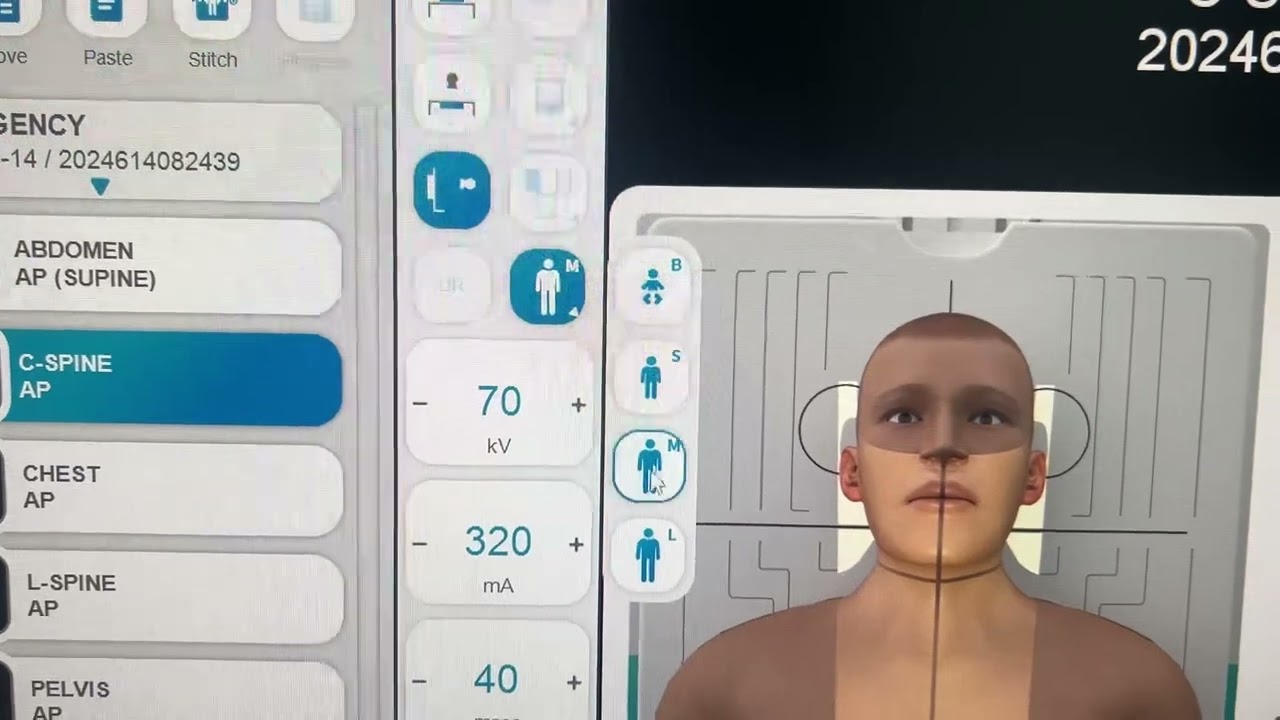 Register a new x-ray patient on RADMAX