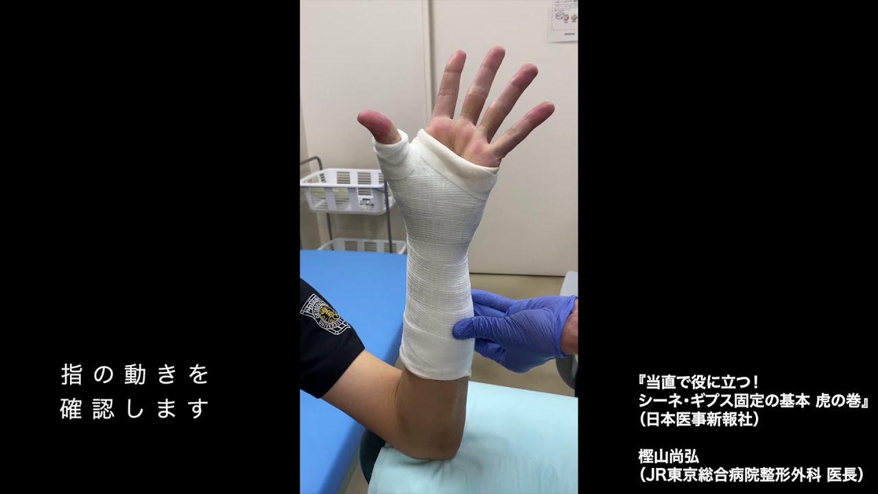 動画16「thumb spica cast」