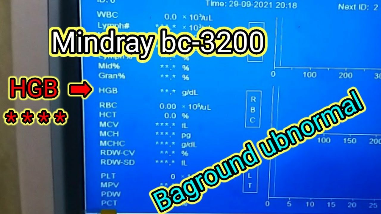 mindray bc-3200 baground ubnormal #hematologimindray #mindraybc3200 #bagroundubnormal #hgberror