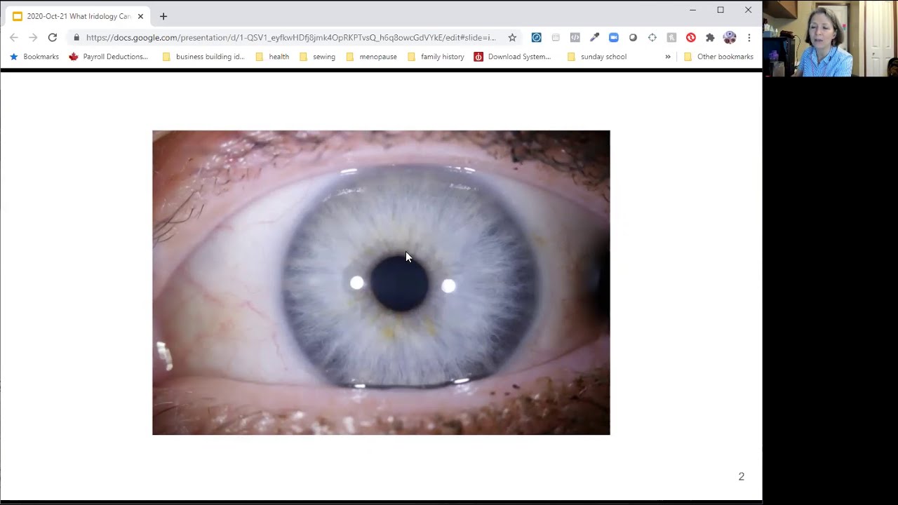 How to Give MORE Value in an Iris Assessment
