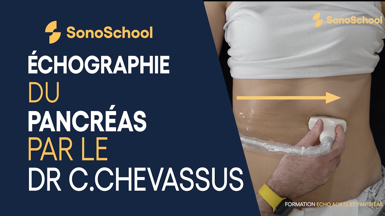 L’examen échographie du pancréas par le Dr C.Chevassus – iSonic | SonoSchool