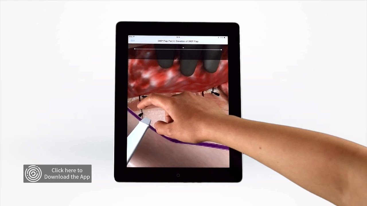 Touch Surgery Simulation- DIEP Flap