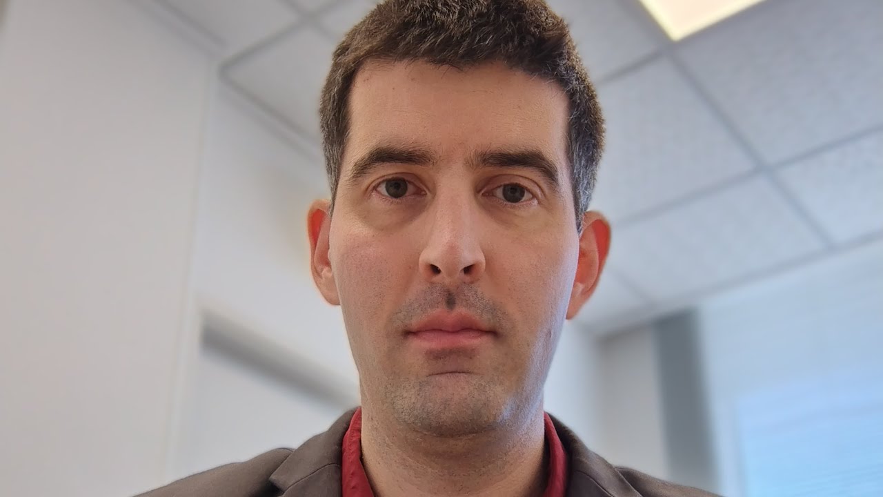 Casos raros na perícia -Cegueira cortical e agnosias visuais #avc #neurologista #demência