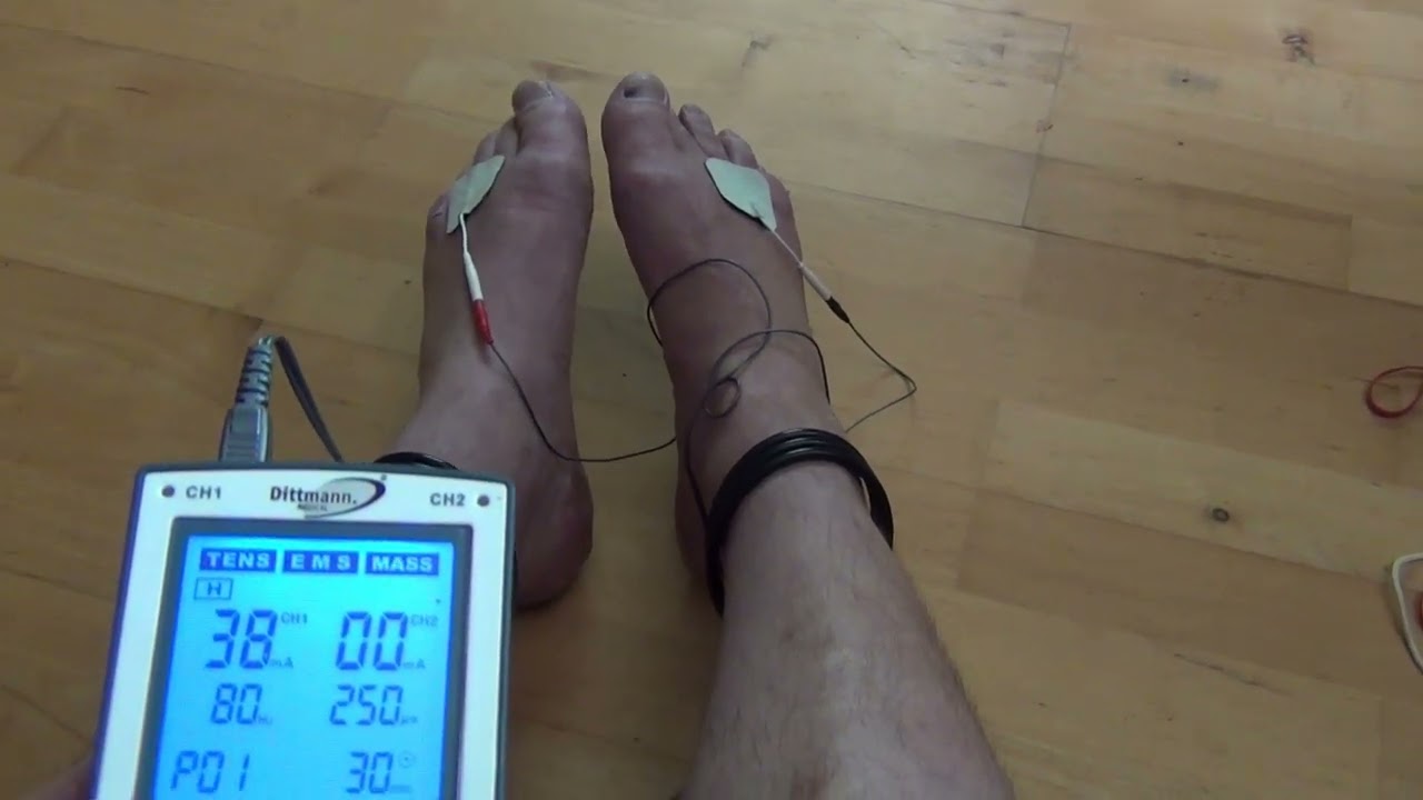 Electro Stimulation