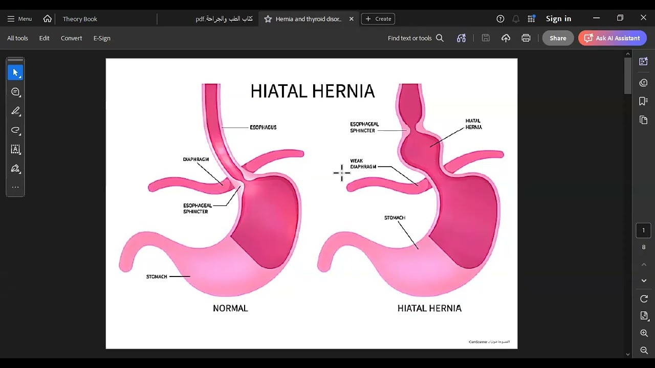 Hernia and thyroid disorder الشابتر الخامس مادة جراحة عامة
