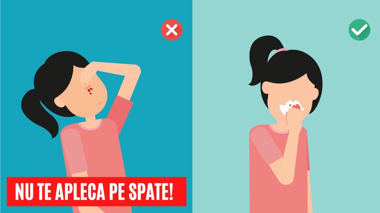 Cum Să Oprești Sângerarea Nazală?
