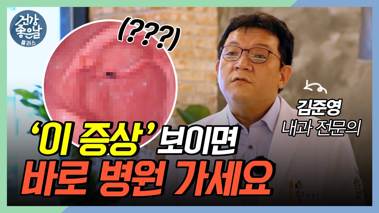 10명 중 1명은 걸린다! 한국인의 고질병😖 #위식도역류질환 [#건강좋은날플러스 ep.40]｜MBC경남 220928 방송