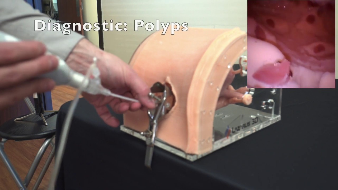 Lazarus 3D - Hysteroscopy Model
