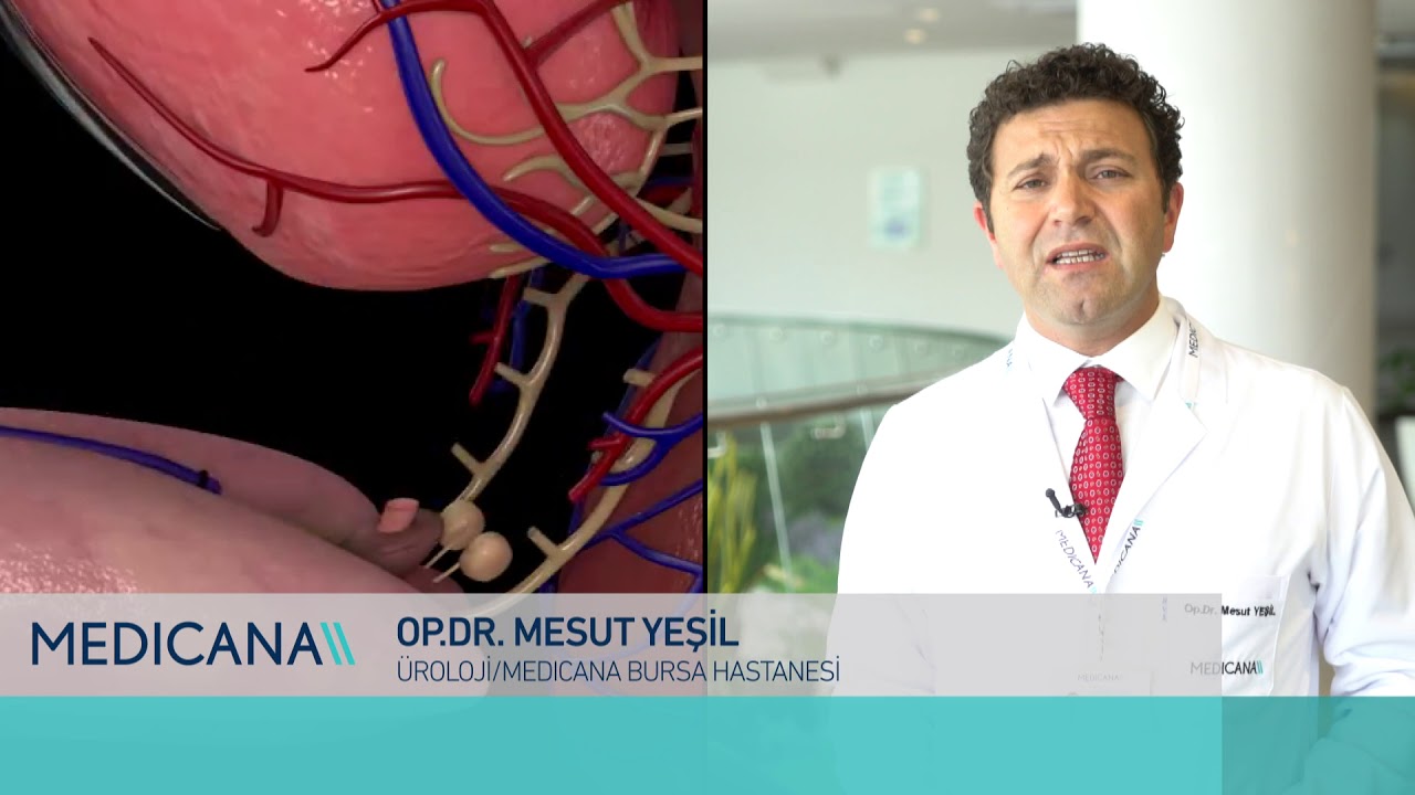 Holep Yöntemi Her Prostat Ameliyatı Olacak Hastaya Önerilebilir Mi?