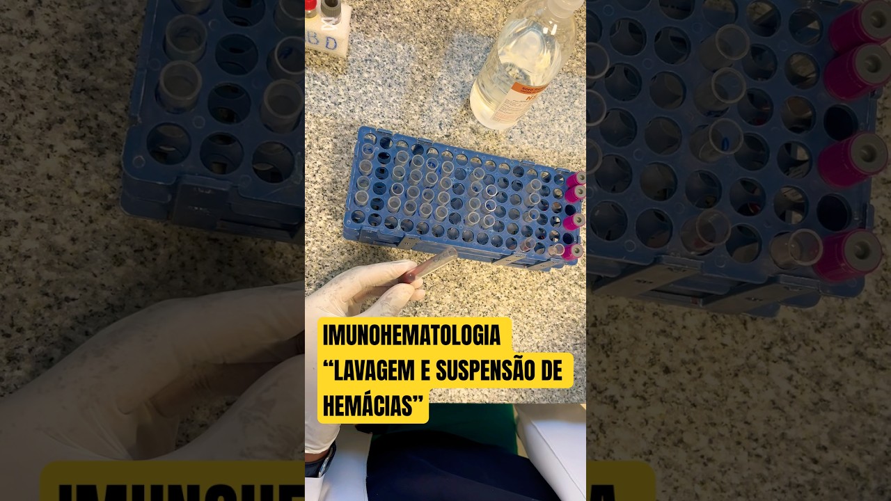 IMUNOHEMATOLOGIA: Lavagem e suspens&atilde;o de Hem&aacute;cias