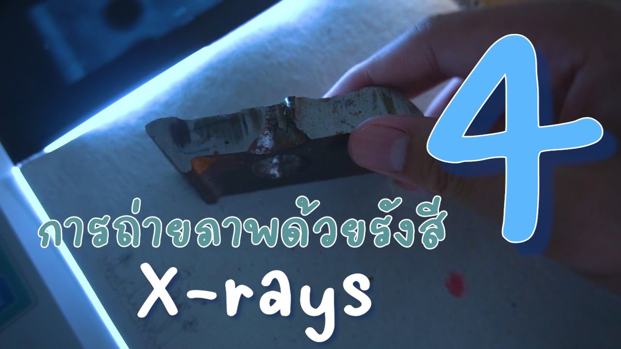 CHAPTER4การถ่ายภาพด้วยรังสีเอ็กซ์
