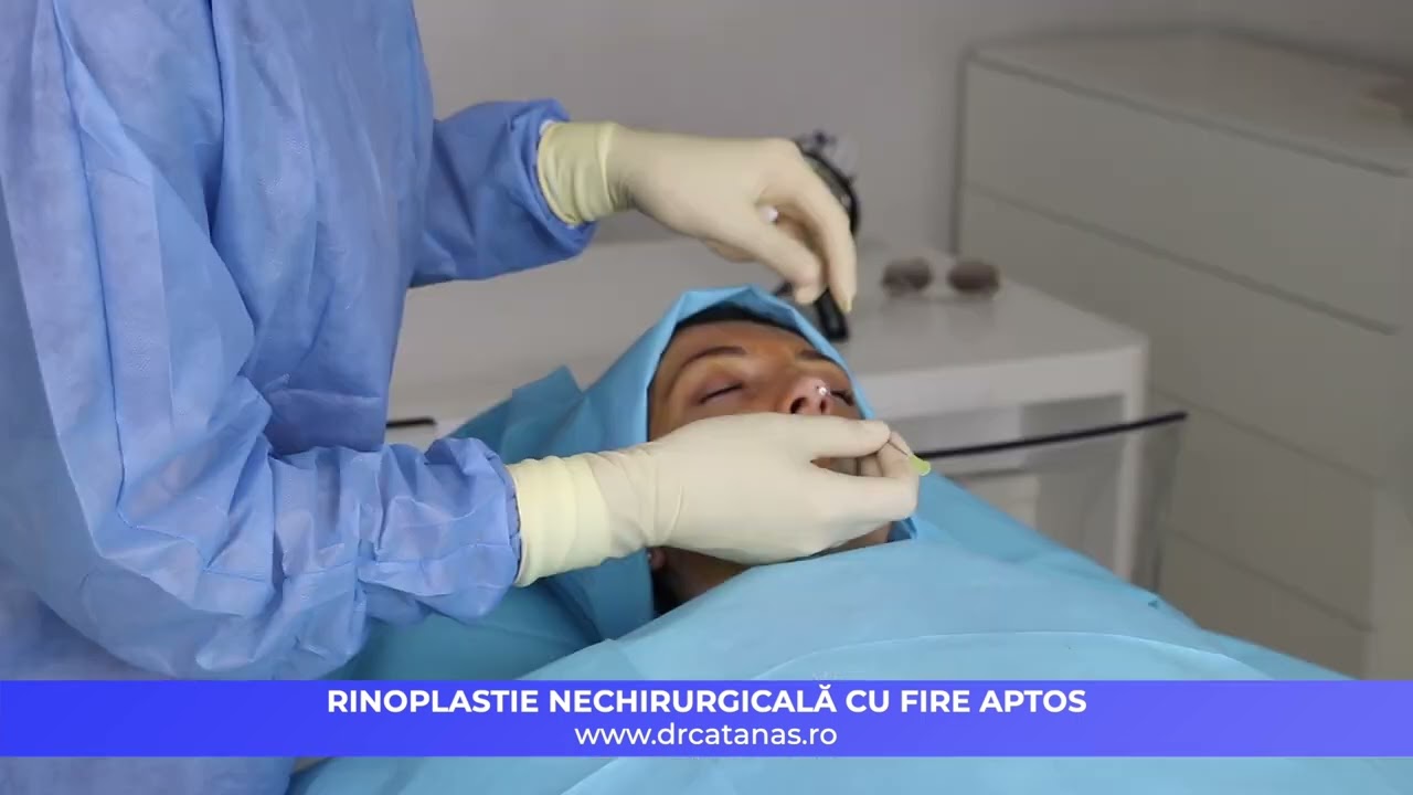 Rinoplastie nechirurgicală cu fire APTOS